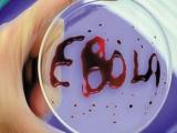 国际英语新闻:Ebola may persist in survivors' eyeballs for months: study